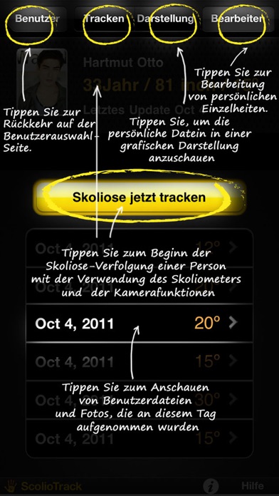 SkolioTrack App-Screenshot