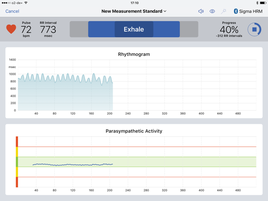 ANS Analysis iPad screenshot 6 - Medical app