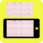 Download ECG Reader app