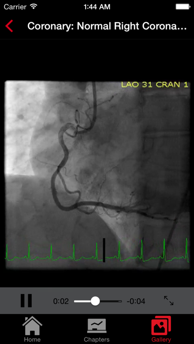 Screenshot #1 pour CathSource