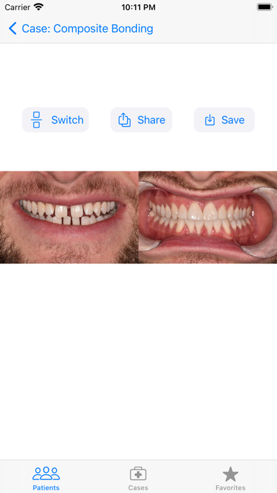 Screenshot 4 of Casebook Before & After Photos App