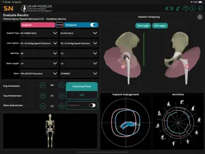 RI.HIP MODELER screenshot #6 for iPad