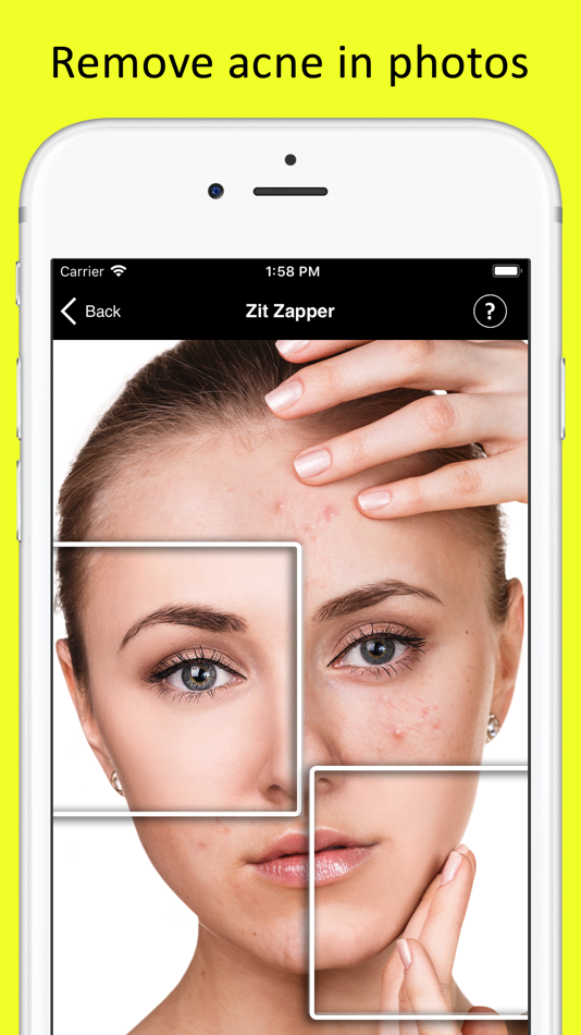 Zit Zapper - Remove Pimples - 2.5 - (iOS)