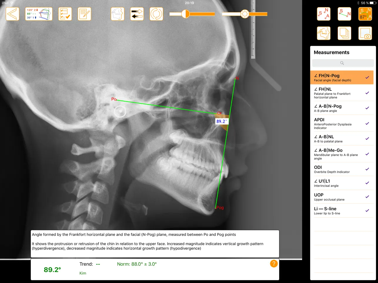 Screenshot #4 pour OrthoLine