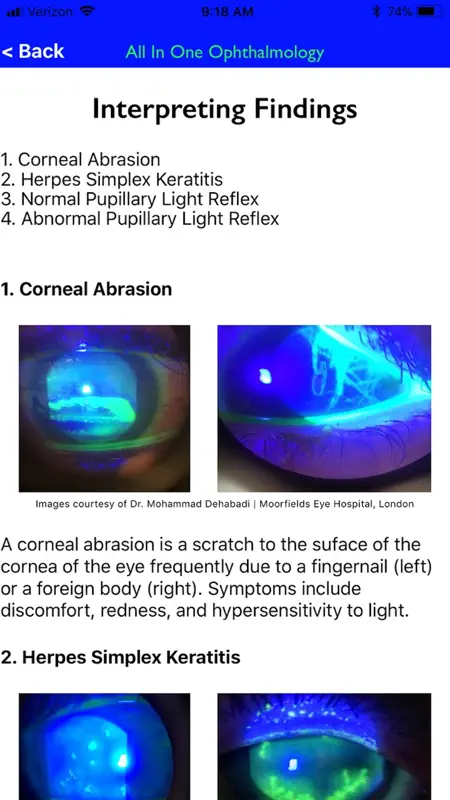 All In One Ophthalmology screenshot 6 of 6