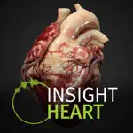 INSIGHT HEART App Support