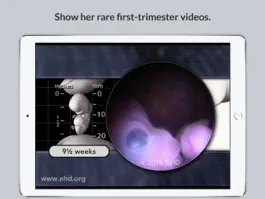 Game screenshot Little One Pregnancy Guide apk