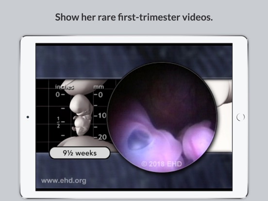 Screenshot #5 pour Little One Pregnancy Guide