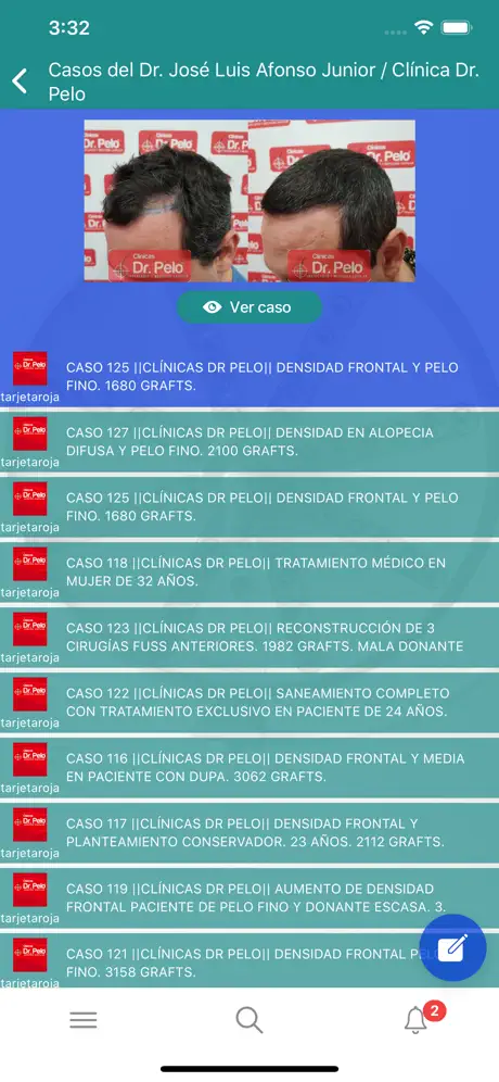 Injerto Capilar