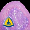 Appendiceal Pathology icon