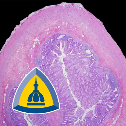 Appendiceal Pathology Читы