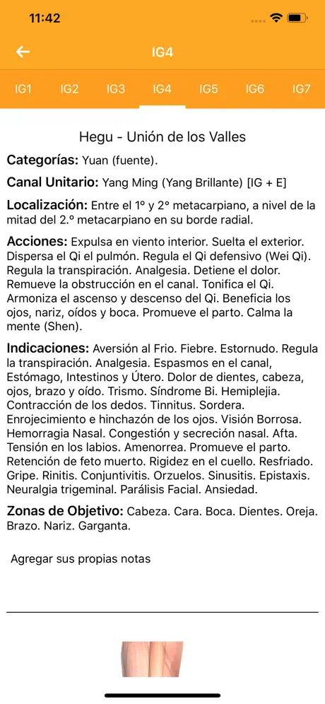 Acupuncture Assistant