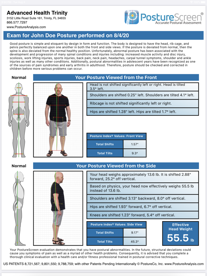 PostureScreen Mobile