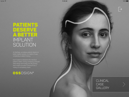 Screenshot #4 pour OssDsign Clinical Case Gallery