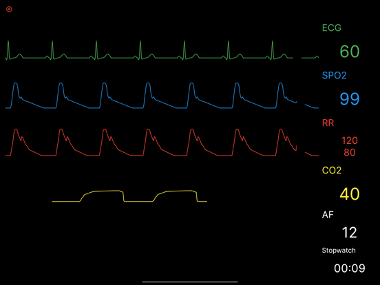 Screenshot #4 pour LIFORTbasic