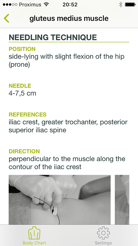 #2. Dry Needling Guide (iOS) 由: BarB BVBA