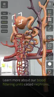 insight kidney iphone screenshot 4