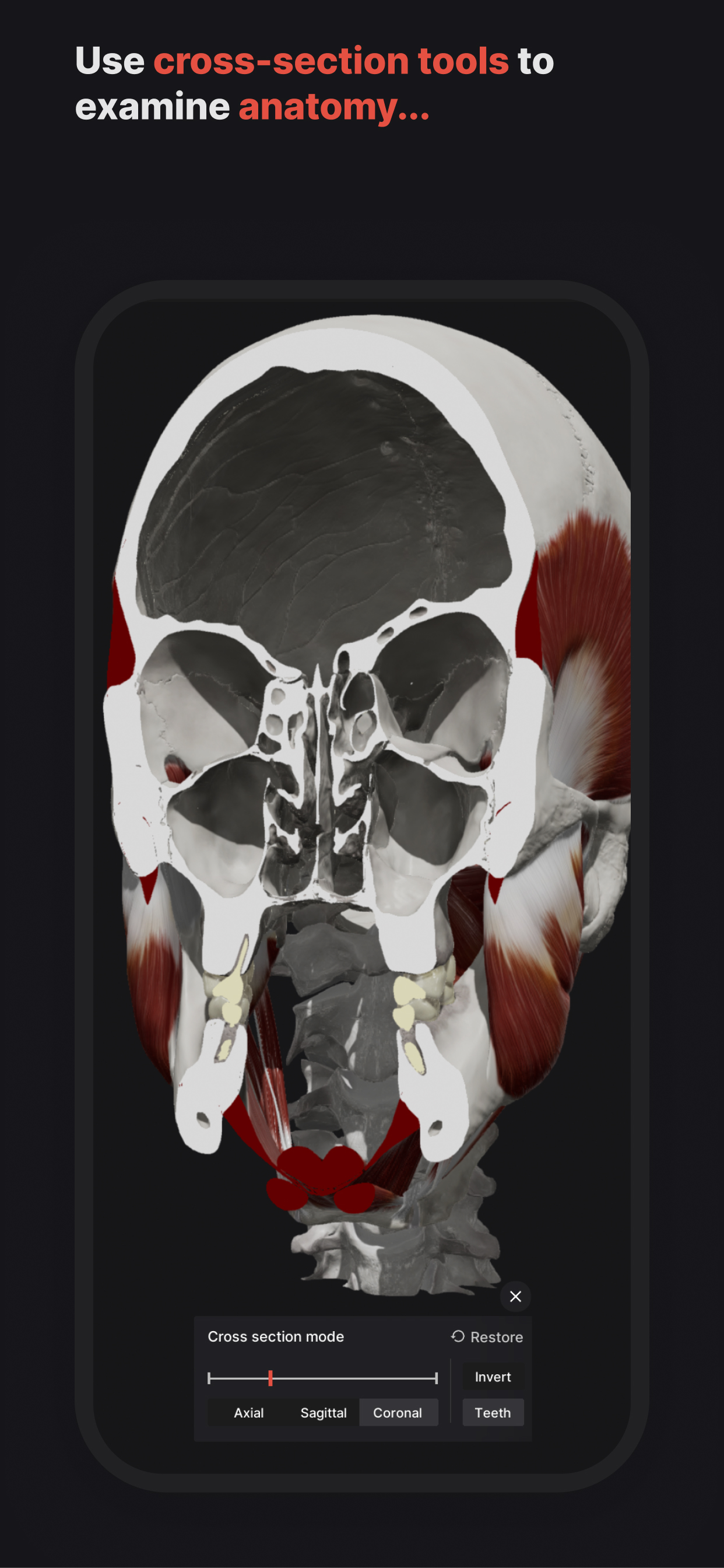 Skull, Teeth & TMJ