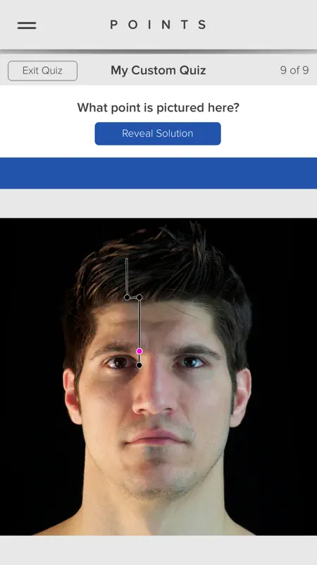 Acupuncture Points screenshot 5 of 5