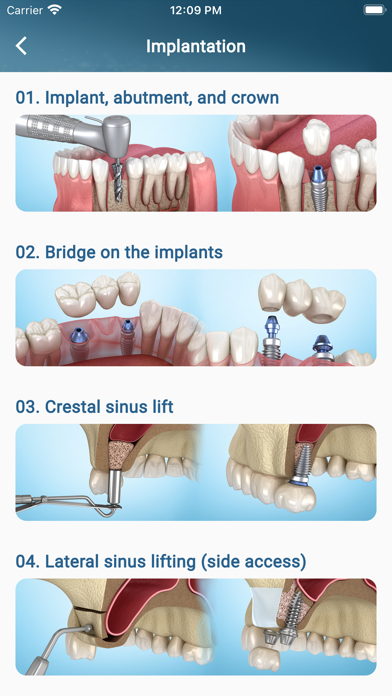 Dental 3D Illustrations Screenshot
