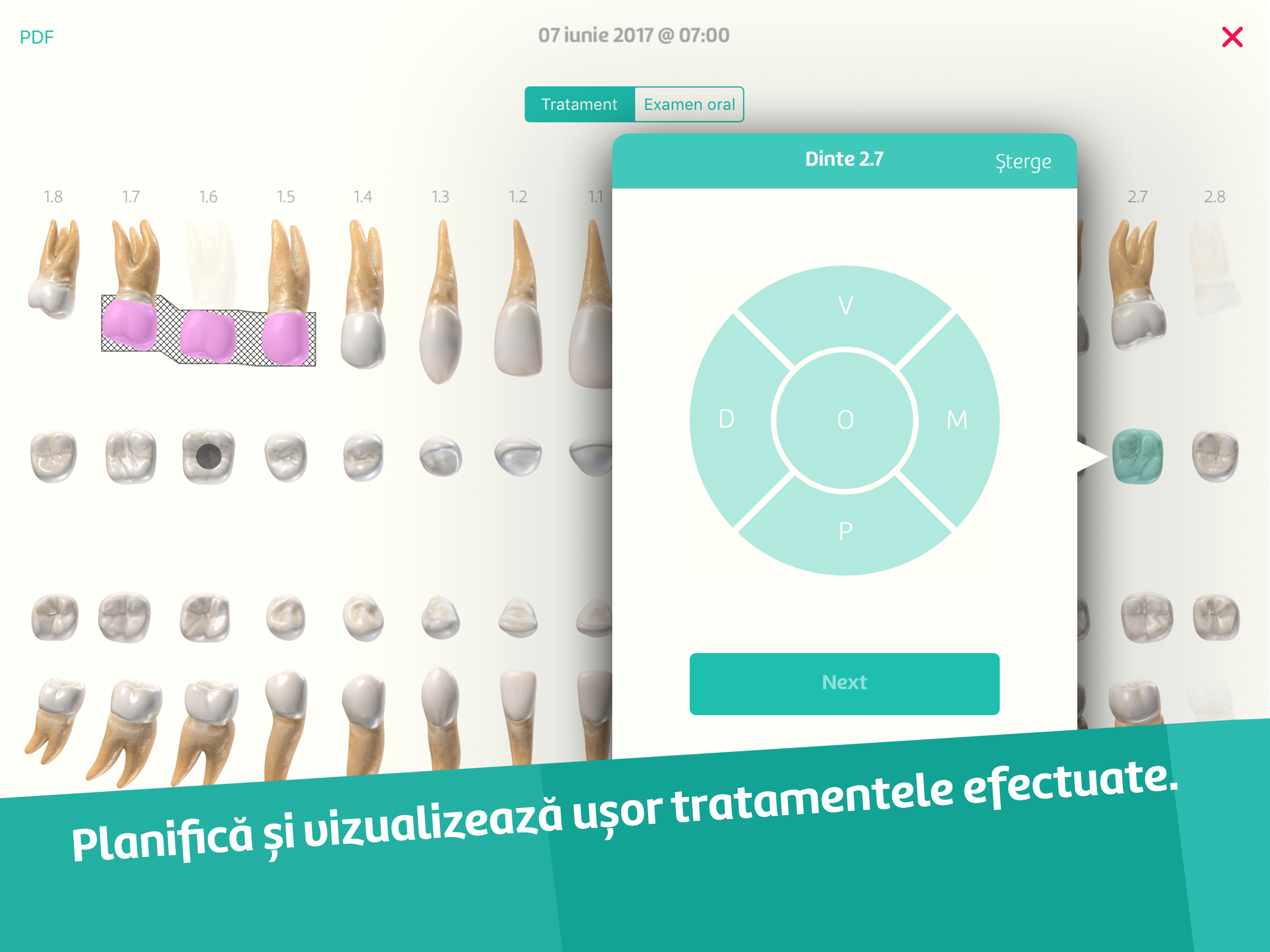 Dentware