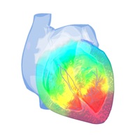 Epicardio Heart Simulator