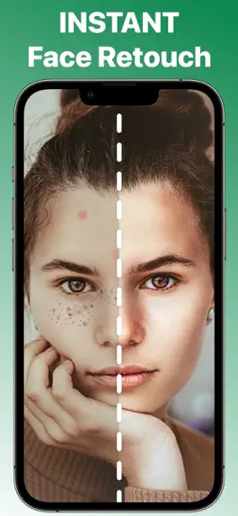 Game screenshot Blemish Remover Face Retouch mod apk