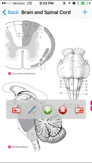Capture d'écran de Anatomy Atlas sur iPhone 2