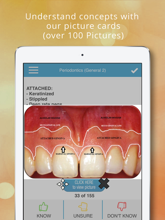 Screenshot #5 pour Periodontics Cram Cards