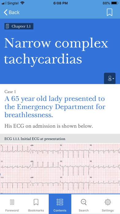 Dr ECG Screenshot