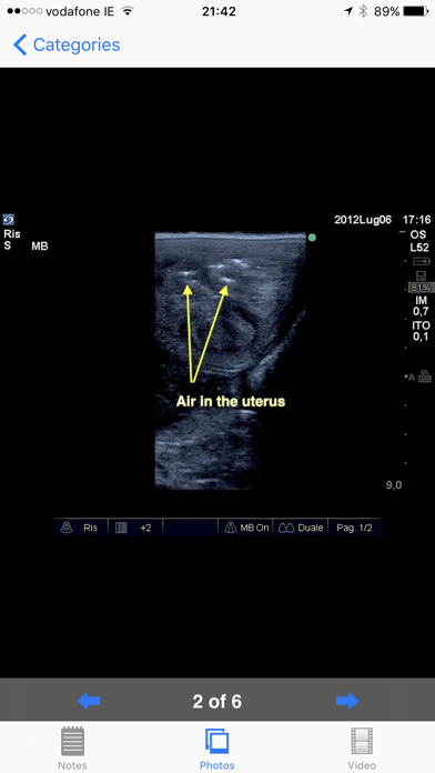 Equine Reproductive Ultrasound Screenshot
