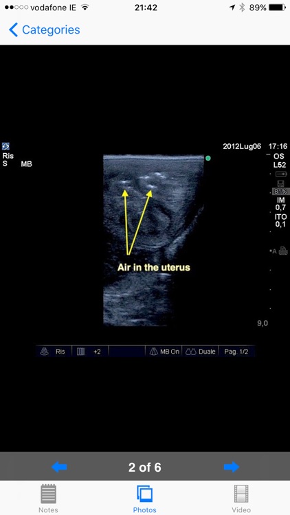 Equine Reproductive Ultrasound