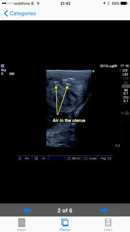 Equine Reproductive Ultrasound screenshot 1 of 5