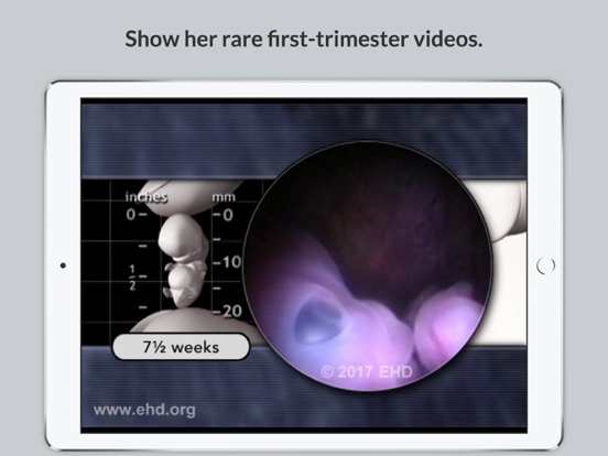 Screenshot #5 pour Baby's Story Pregnancy Guide