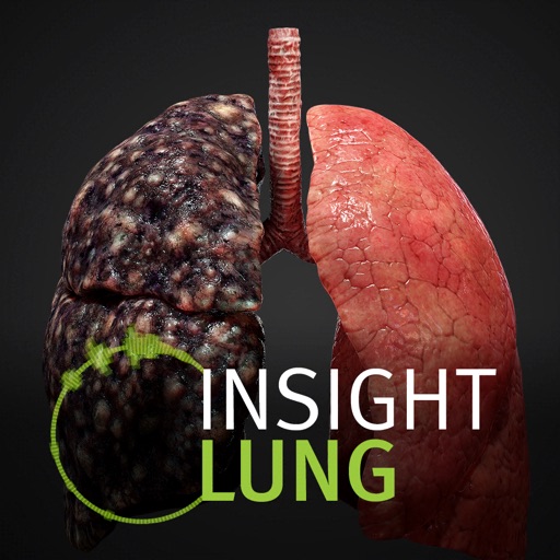 INSIGHT LUNG Download