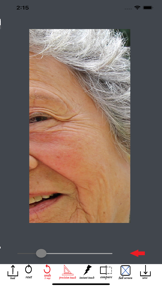 Wrinkle Remover Blemish Editor screenshot