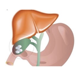 Workly prueba  preoperatoria