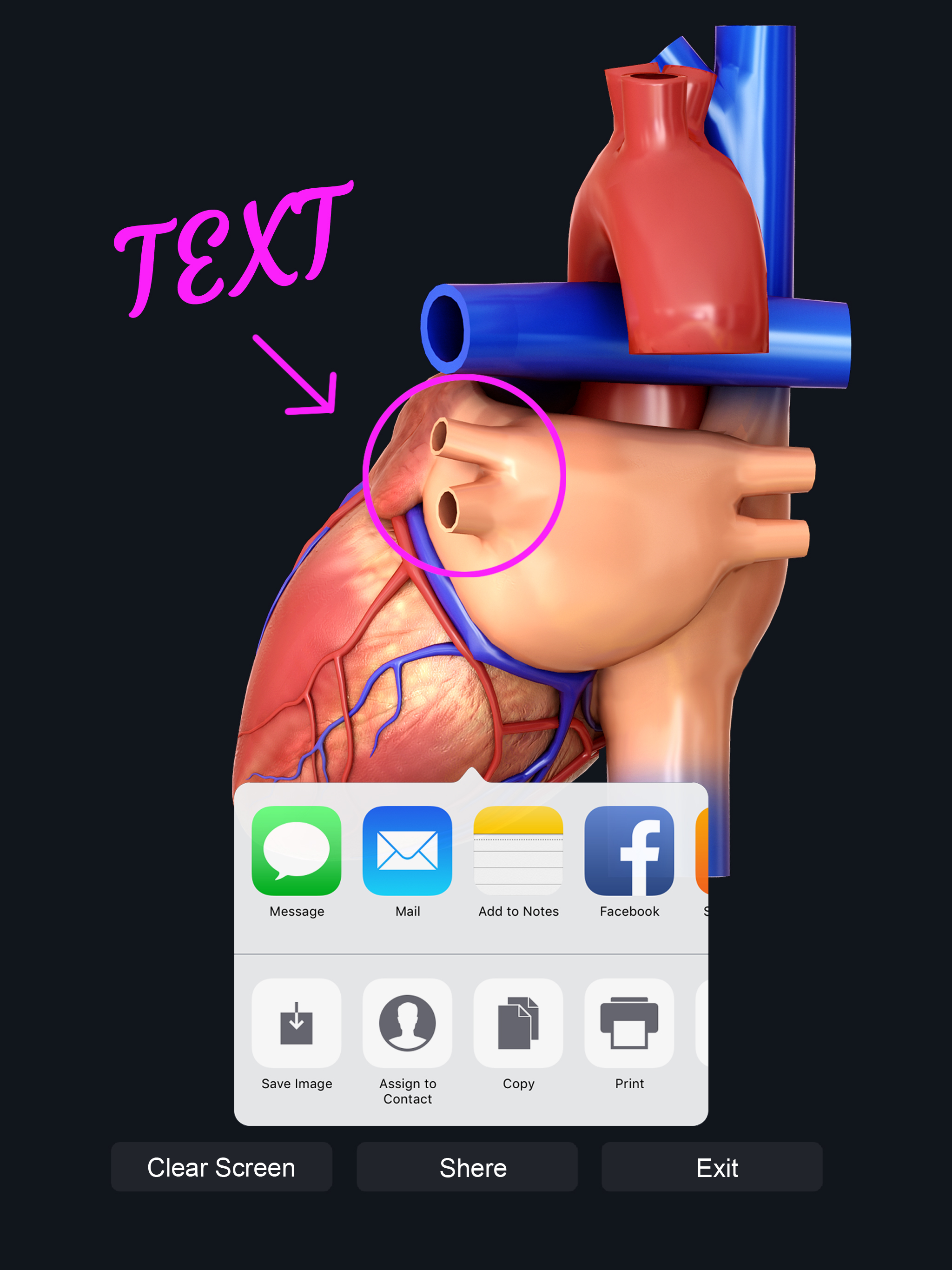 My Heart Anatomy screenshot 11