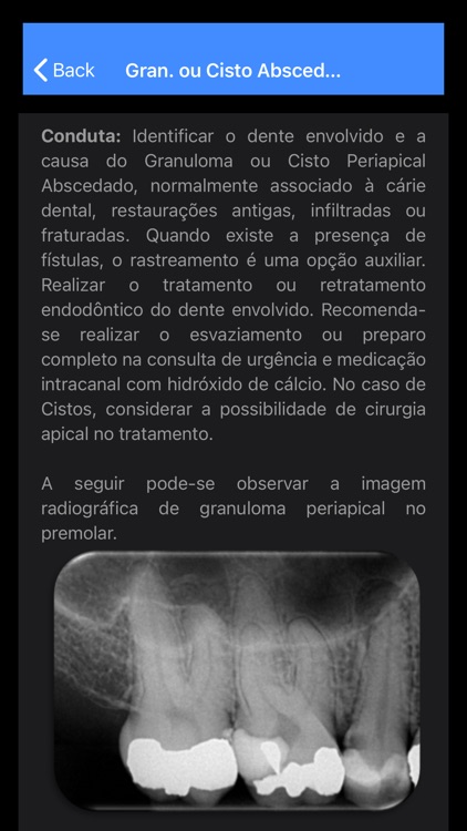 Endo 10 screenshot-6