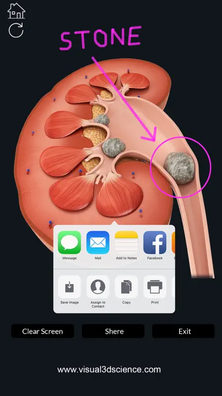 My Kidney Anatomy screenshot 6 of 8