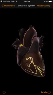 cardiosmart heart explorer iphone screenshot 3