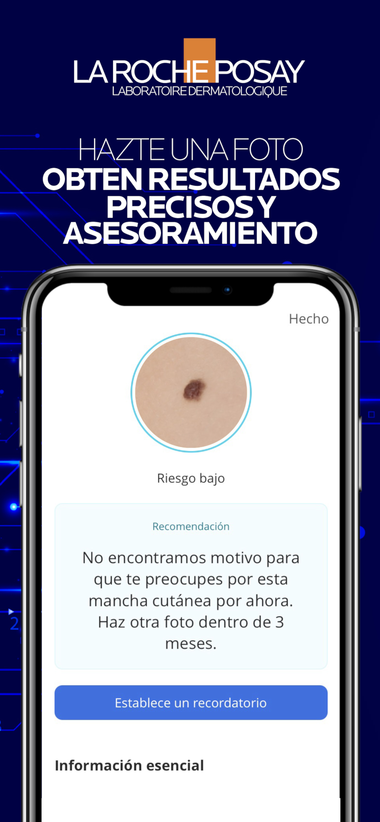 SkinVision - Cáncer de piel