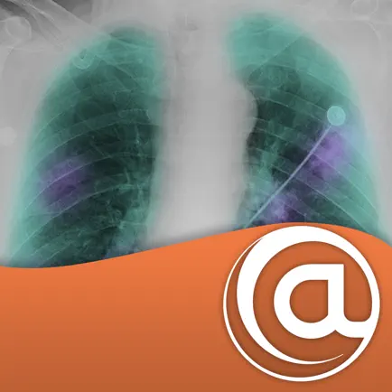 COPD @Point of Care™ Cheats