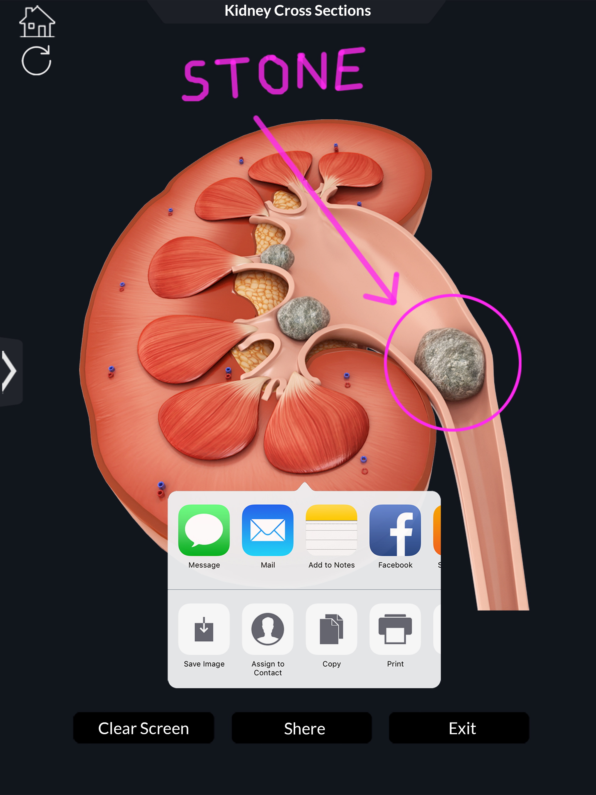 Urinary System screenshot 13