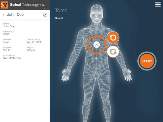 Screenshot #6 pour SpinalTech3D Scan