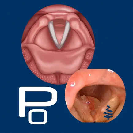 Vocal Pathology: Polyps Читы