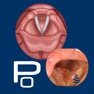 Get Vocal Pathology: Polyps for iOS, iPhone, iPad Aso Report