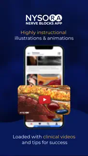 nysora nerve blocks iphone screenshot 3