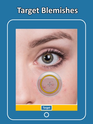 Blemish Remover Photo Toolのおすすめ画像2
