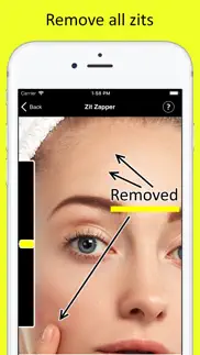 How to cancel & delete zit zapper - remove pimples 1